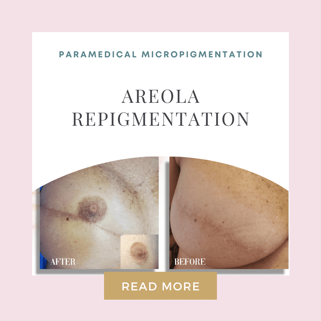 Areola Repigmentation