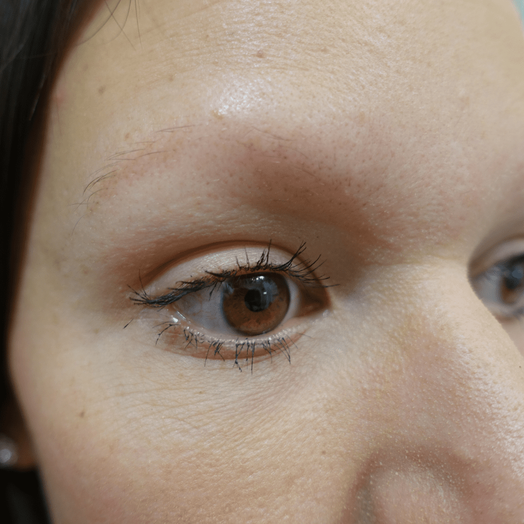 Problems with Brows
